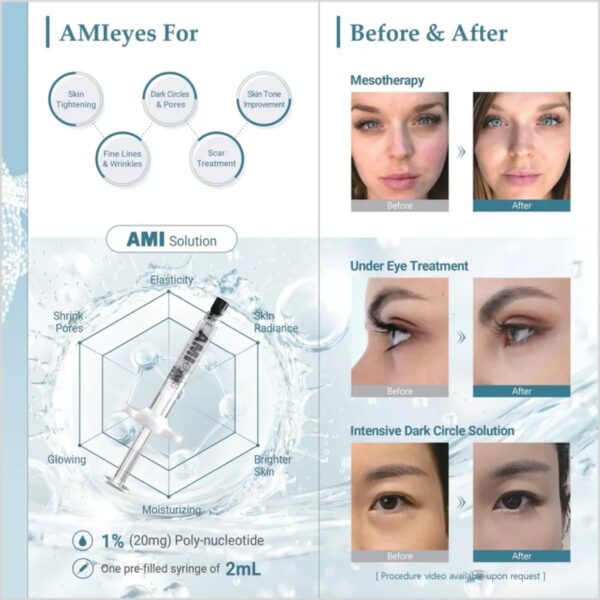 AMI Eyes filler for Dark Circles - Made in Korea - Image 3